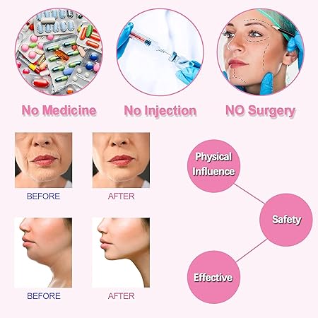V-Shape Facial Slimming Strap – Reusable Face & Jawline Lifting Support Band