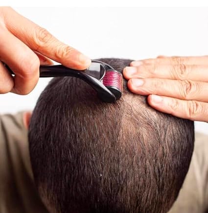 Derma Roller for Scalp & Beard Care – Manual Microneedling Roller for Men
