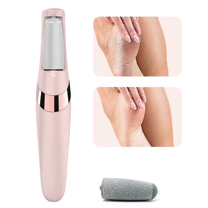 Electric Foot Callus Remover & Pedicure Foot File – Pink
