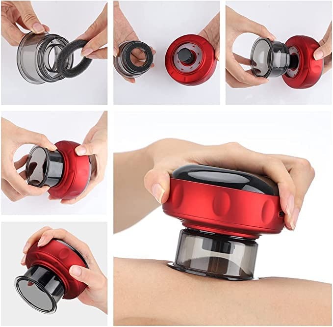Electric Cupping Massage Device with Suction & Warming Function – Portable Body Massage Cup