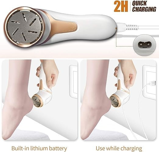 Electric Foot File with 3 Roller Heads – Vacuum Callus & Dead Skin Remover