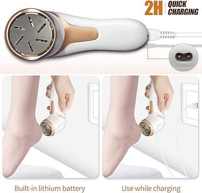 Electric Foot File with 3 Roller Heads – Vacuum Callus & Dead Skin Remover